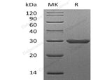 Recombinant Human Galectin-3/LGALS3 Protein (Active)