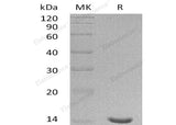 Recombinant Human Galectin-7/LGALS7 Protein (Active)