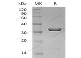 Recombinant Human Galectin-8/LGALS8 Protein (Active)