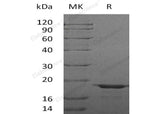 Recombinant Human LGALSL Protein (His Tag)