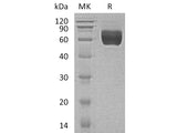 Recombinant Human GALNTL1 Protein (His Tag)