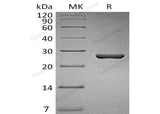 Recombinant Human Gankyrin/PSDM10 Protein