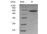 Recombinant Human Gastric Lipase/LIPF Protein (Human Cells, His Tag)