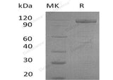 Recombinant Human GFRRA2 Protein ((Fc & His Tag)