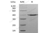 Recombinant Human TSTA3/SDR4E1 Protein (His Tag)