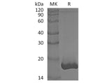 Recombinant Human GMFB Protein (His Tag)