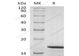 Recombinant Human GDNF Protein (Active)