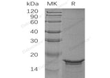 Recombinant Human GFAP Protein (His Tag)