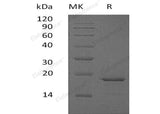 Recombinant Human Glucagon/GCG Protein (His Tag)