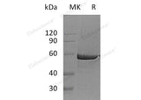 Recombinant Human G6PD Protein (His Tag)