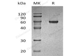 Recombinant Human GLUL Protein (His Tag)