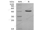 Recombinant Human GCDH Protein (His Tag)