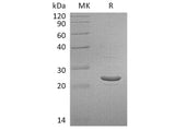 Recombinant Human GSTP1 Protein