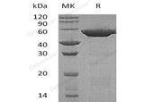 Recombinant Human GSS Protein (His Tag)