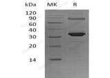 Recombinant Human GNMT Protein (His Tag)