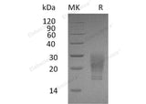 Recombinant Human GM-CSF/CSF2 Protein (His Tag, Cells)(Active)