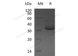 Recombinant Human GPD1/GDP-C Protein (Human Cells, His Tag)