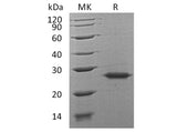 Recombinant Human Grancalcin/GCA Protein