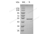 Recombinant Human Grancalcin/GCA Protein (GST Tag)