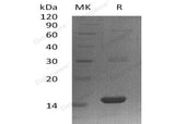 Recombinant Human PLA2G16 Protein (His Tag)