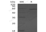 Recombinant Human Growth Arrest-Specific Protein 7/GAS7 Protein (His Tag)