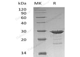 Recombinant Human GRB2 Protein (His Tag)