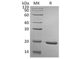 Recombinant Human GH1/Growth hormone 1 Protein