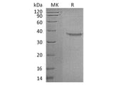 Recombinant Human Somatoliberin/GHRH Protein (Fc Tag)