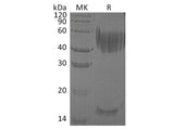 Recombinant Human Haptoglobin/Zonulin Protein (aa 19-160&aa 162-406, His Tag)