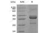 Recombinant Human Haptoglobin/Zonulin Protein (aa 145-406, His Tag)