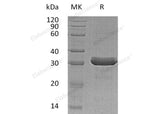 Recombinant Human HDGFRP3/HDGFL3 Protein (His Tag)