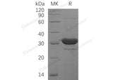 Recombinant Human HDHD2 Protein (His Tag)