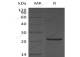 Recombinant Human HSPB2/MKBP Protein (His Tag)