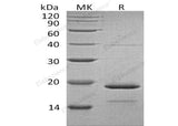 Recombinant Human HSPB7 Protein (His Tag)