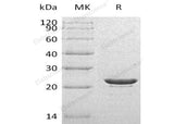 Recombinant Human HSPB8 Protein (His Tag)