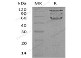 Recombinant Human HCLS1 Protein (His Tag)