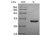 Recombinant Human HO-1/HMOX1 Protein