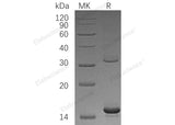 Recombinant Human HBAZ Protein (His Tag)