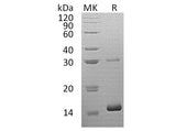 Recombinant Human HBQ1 Protein (His Tag) 