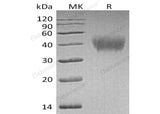 Recombinant Human HEPACAM Protein (His Tag)