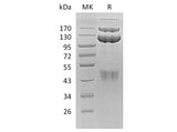 Recombinant Human HGFR/c-MET Protein (Fc Tag)(Active)