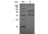 Recombinant Human HGFR/c-MET Protein (aa 25-519, His Tag)