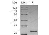 Recombinant Human HGF Protein (His Tag)(Active)