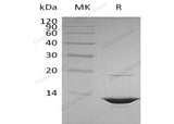 Recombinant Human HMGB1 Protein (MARI Tag)