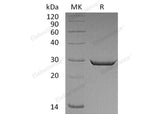 Recombinant Human HMGB2 Protein (His Tag)