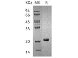 Recombinant Human HPCAL1 Protein (His Tag)