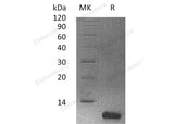 Recombinant Human Histatin-3/HTN3 Protein