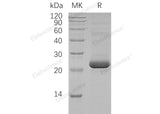 Recombinant Human ASF1A Protein (His&T7 Tag)