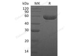 Recombinant Human Hyaluronidase-1/HYAL1 Protein (His Tag)