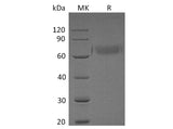 Recombinant Human ORP150/HSP12A Protein (His Tag)